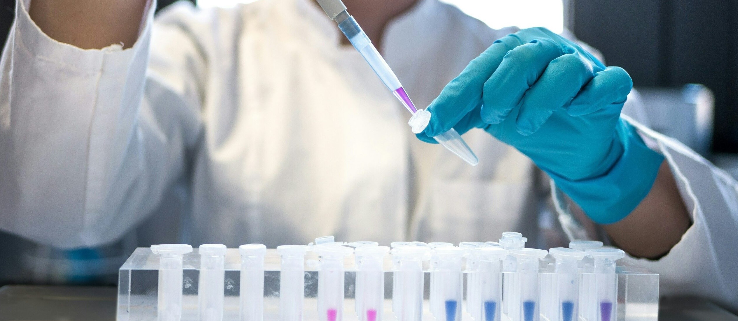 Virus shamonda, el virus que dio el salto al ser humano: ¿qué es, cómo se contagia y cuáles son sus síntomas? - -